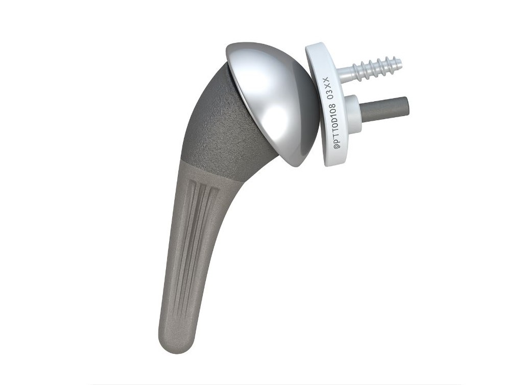 anatomische Schulterprothese von dr. timmel von ortho-timmel.at